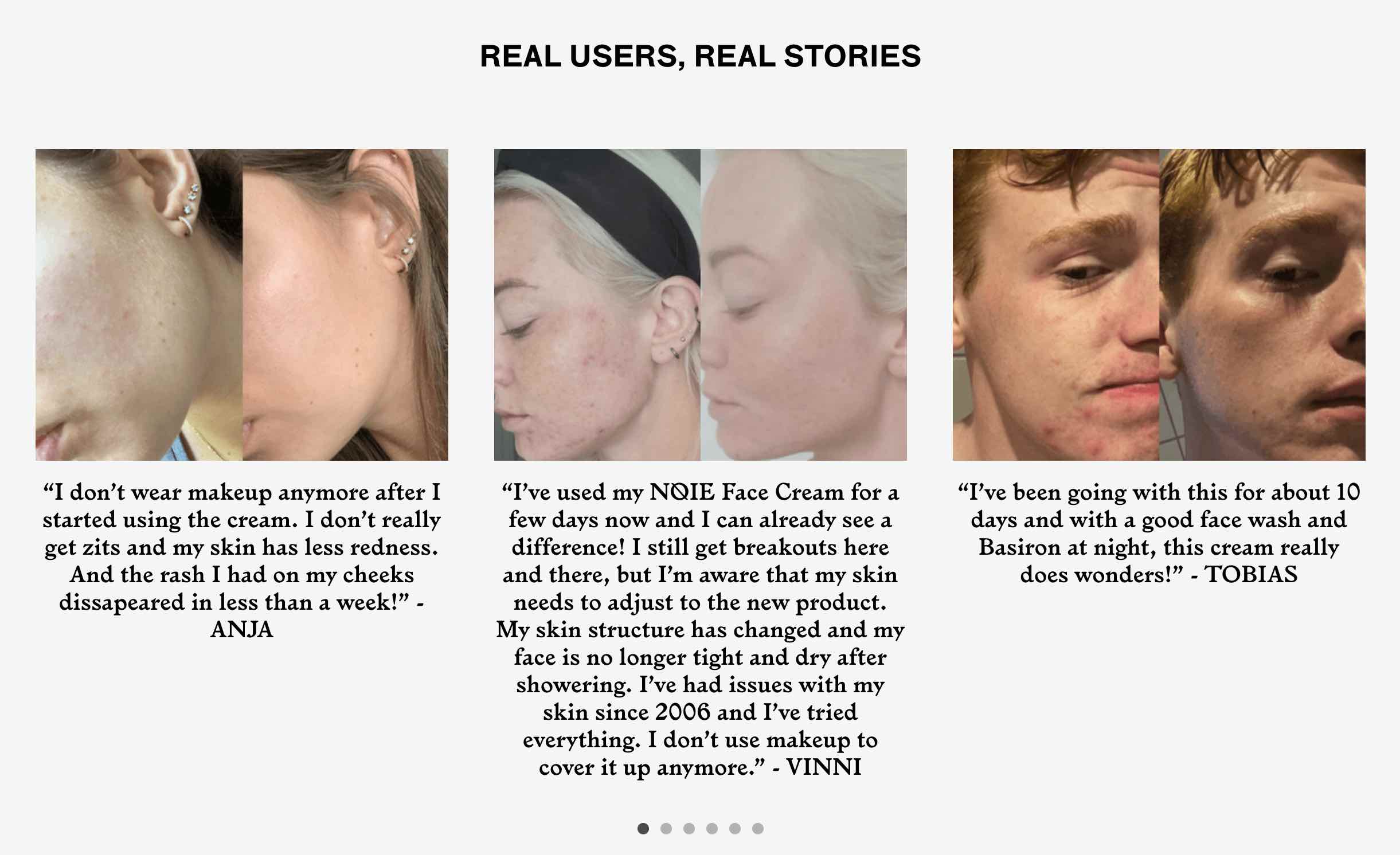 N&oslash;ie-user-reviews